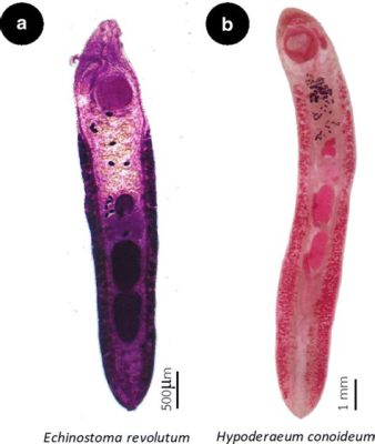  Echinostoma revolutum: A Parasite That Lives a Life More Dramatic Than Any Soap Opera!